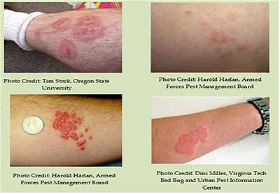 출처 Tackling bed bugs A starter guide for local governments