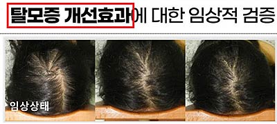 화장품을 의약품으로 오인혼동 광고