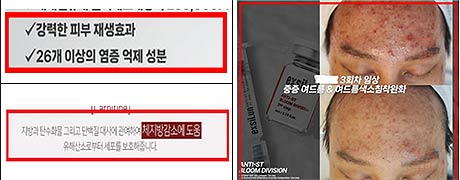 의약품 오인 우려 광고 문구