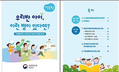 21삼염색체증다운증후군