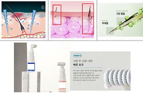 피부 내 화장품 주입전달 광고 적발 사례