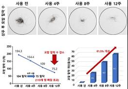 인체적용시험으로 확인된 보리밥나무의 '탈모예방 및 개선 효과' 기사 이미지
