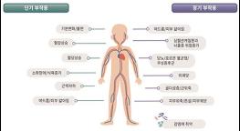 중증 천식 환자, 전신 스테로이드 안전하게 줄이기! 기사 이미지