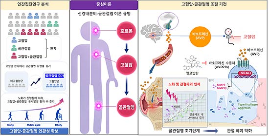 고혈압이 관절까지 망가뜨린다 뇌 호르몬 AVP가 골관절염 악화시키는 기전 규명