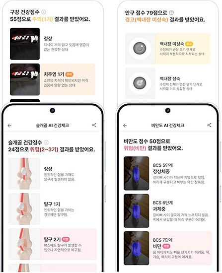 AI 분석 결과 화면